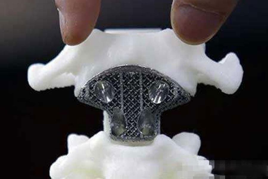 3D printing service machining in the medical device industry